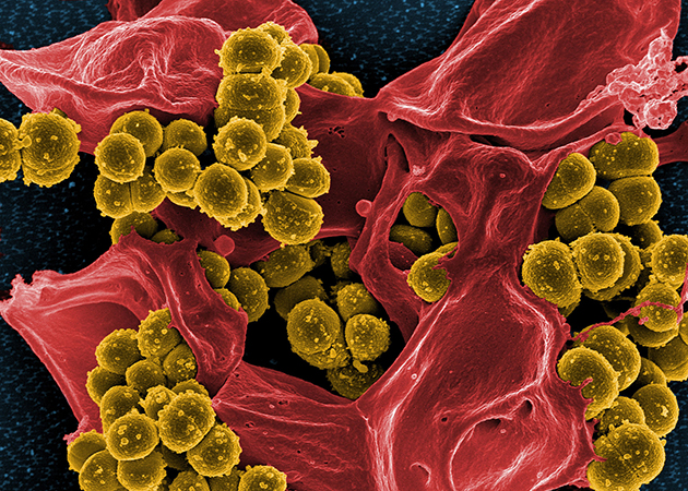 Researchers see weakness in MRSA’s resilience